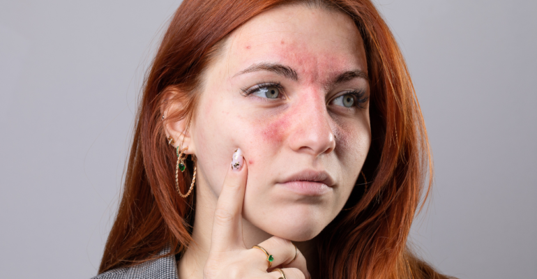 Soothing Ingredients: A Complete Dermatologist Guide