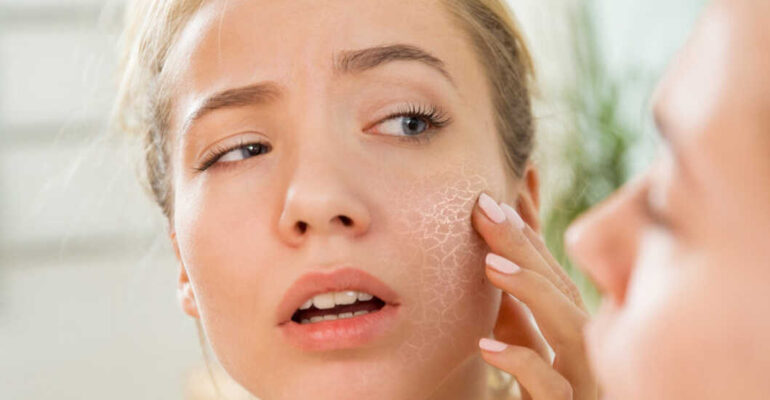 Dry Skin: Dermatologist Guide