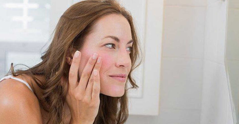 Sensitive skin or Rosacea: Dermatologist Guide