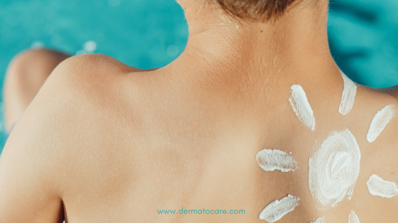 Kids Sunscreen: Dermatologist’s Guide
