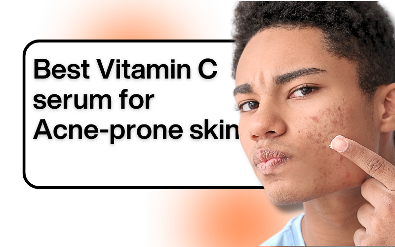 Best Vitamin C Serums for Oily & Acne-Prone Skin(2026): Fade Marks Without Breakouts