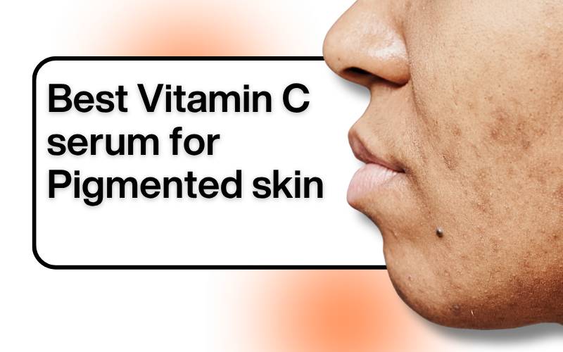 Top 6 Vitamin C Serums to Fade Dark Spots & Hyperpigmentation (2026)