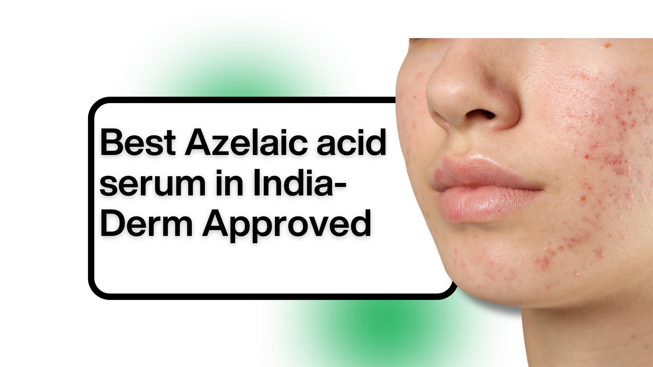 6 Best Azelaic Acid Serums for Acne, Dark Marks & Redness: A Dermatologist's Guide